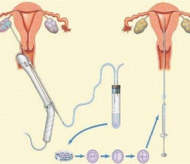 35岁女性备孕请做好以下检查，“健康珠海代生宝宝”跑不远